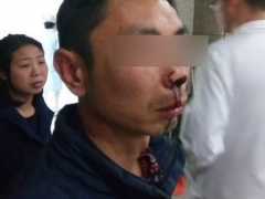 因要求實名簽收 快遞員遭暴打致鼻梁骨折