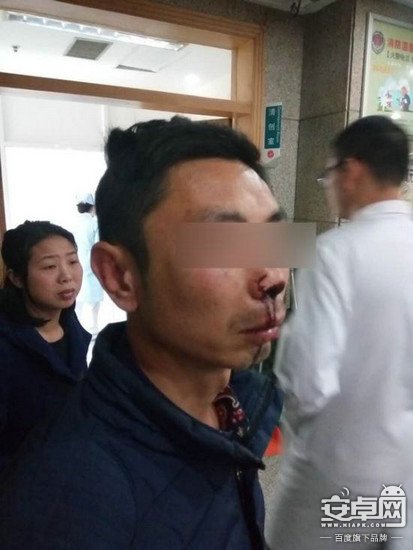 快遞員遭暴打致鼻梁骨折臉部血腫 因要求快遞員實(shí)名簽收