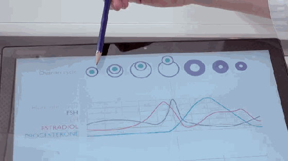 這事有點(diǎn)污 夫妻想懷孕居然靠這款手環(huán)就行了