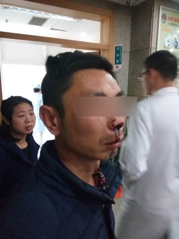 快遞員稱叫收件人實名簽收遭暴打，警方：已立案調查